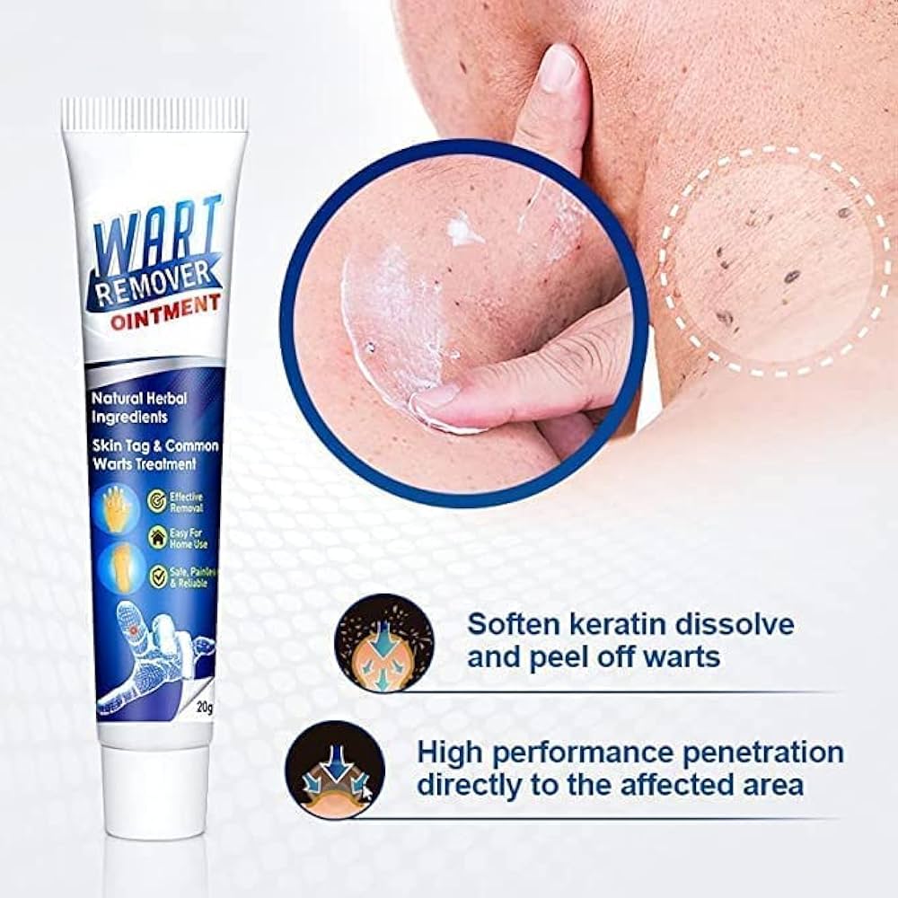 Wart Remover Ointment – Targeted At-Home Care for Common Warts