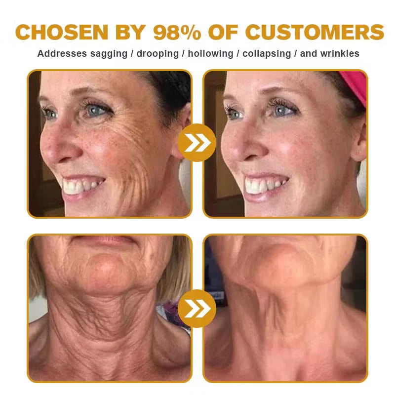 Botox Bee Venom Wrinkle Removal Cream